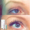 realash serum para pestañas